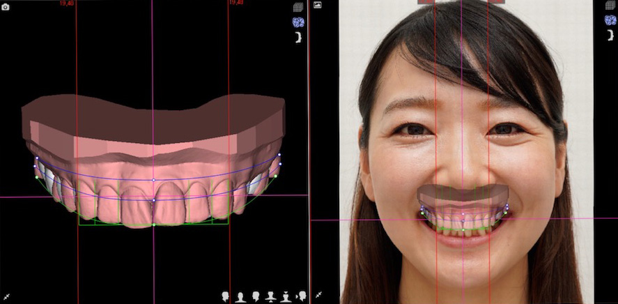 歯並びとお顔を総合的にデジタルで診断します。